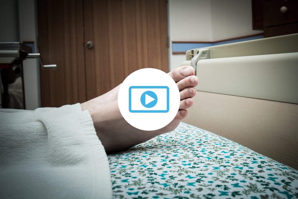 Close detail women's foot in hospital