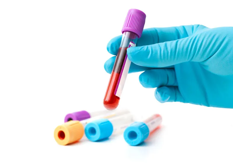 Homepage Hero - NW London
