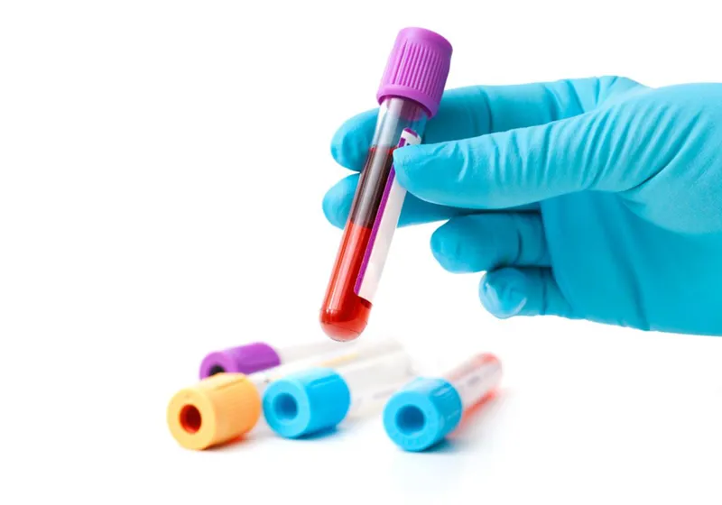 Know more - blood test sample
