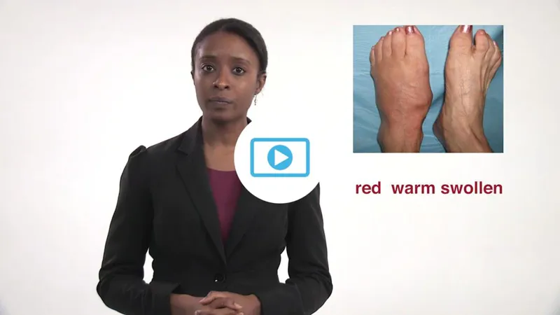 Presenter beside a photo of red, warm, swollen feet