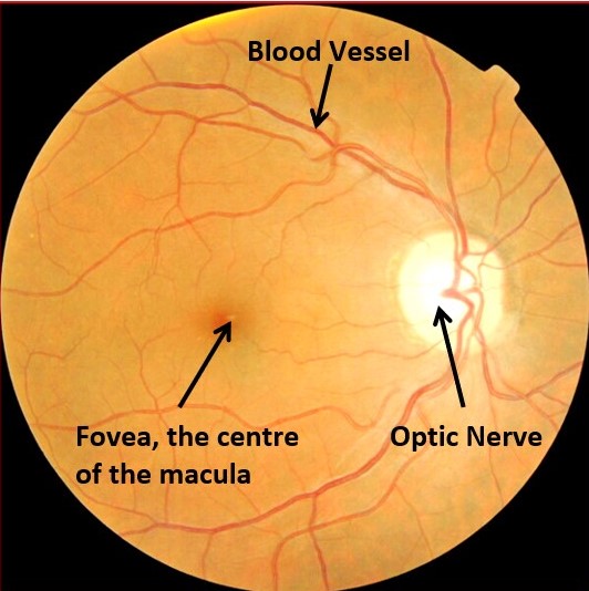 Retinal photograph labelling the optic nerve, a blood vessel and the fovea at the centre of the macula