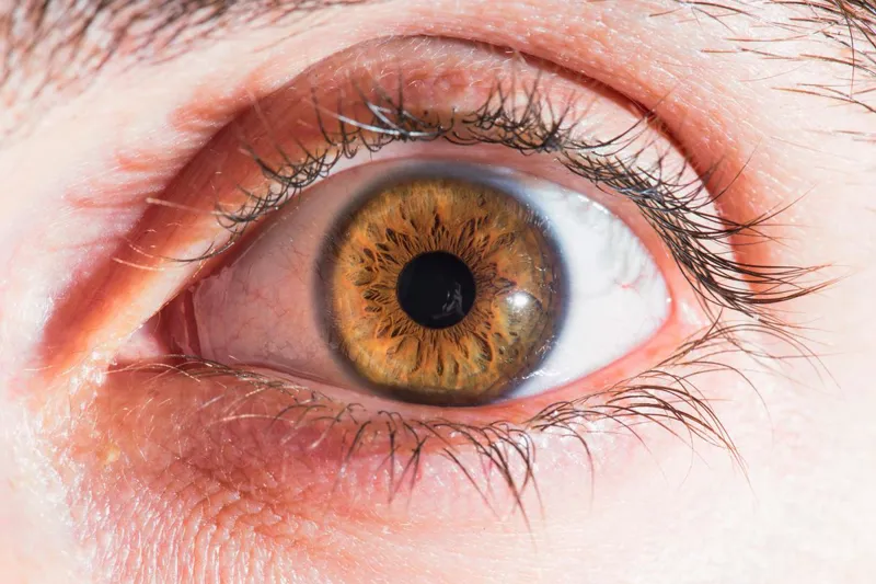 Close up of an eye