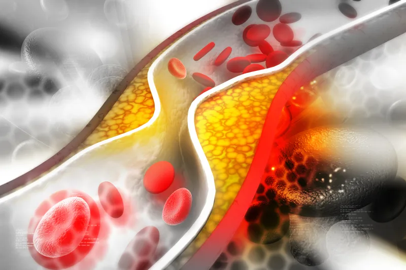 Your blood - bloodcholdiab4 (1)