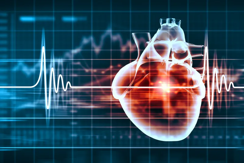 eLearning - heartbeat-1000x667 (1)